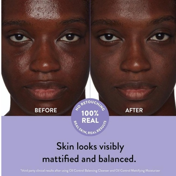 Peach Slices Mattifying Moisturizer - Picture 7 of 11